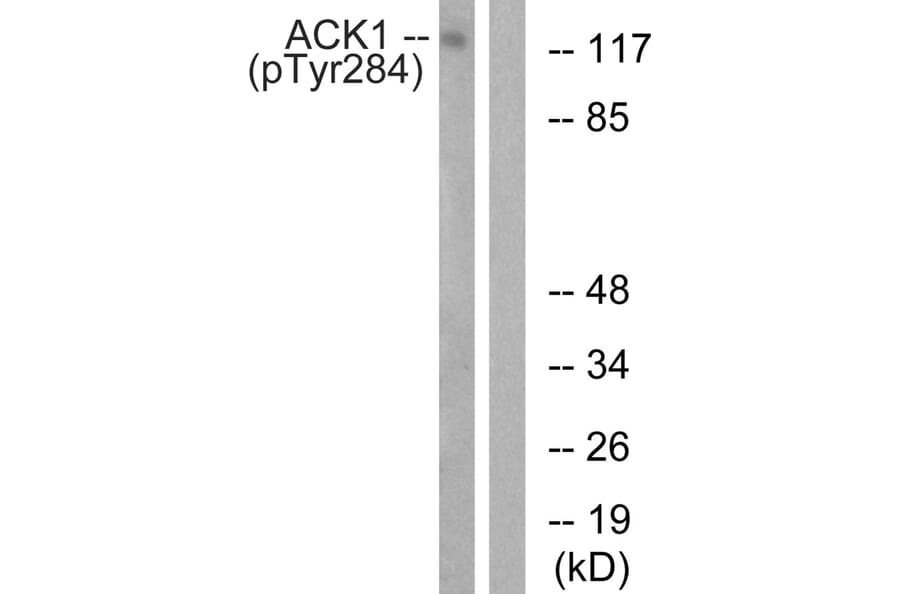 Western blot - ACK1 (Phospho-Tyr284) Antibody from Signalway Antibody (11671) - Antibodies.com