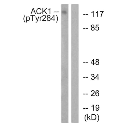 Western blot - ACK1 (Phospho-Tyr284) Antibody from Signalway Antibody (11671) - Antibodies.com