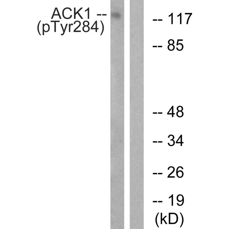 Western blot - ACK1 (Phospho-Tyr284) Antibody from Signalway Antibody (11671) - Antibodies.com