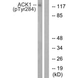 Western blot - ACK1 (Phospho-Tyr284) Antibody from Signalway Antibody (11671) - Antibodies.com