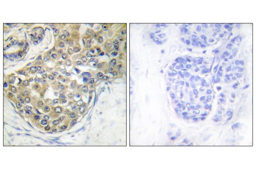 Immunohistochemistry - ACK1 (Phospho-Tyr284) Antibody from Signalway Antibody (11671) - Antibodies.com