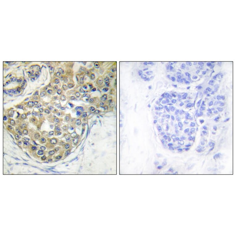 Immunohistochemistry - ACK1 (Phospho-Tyr284) Antibody from Signalway Antibody (11671) - Antibodies.com