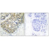 Immunohistochemistry - ACK1 (Phospho-Tyr284) Antibody from Signalway Antibody (11671) - Antibodies.com