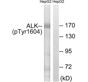 Western blot - ALK (Phospho-Tyr1604) Antibody from Signalway Antibody (12127) - Antibodies.com