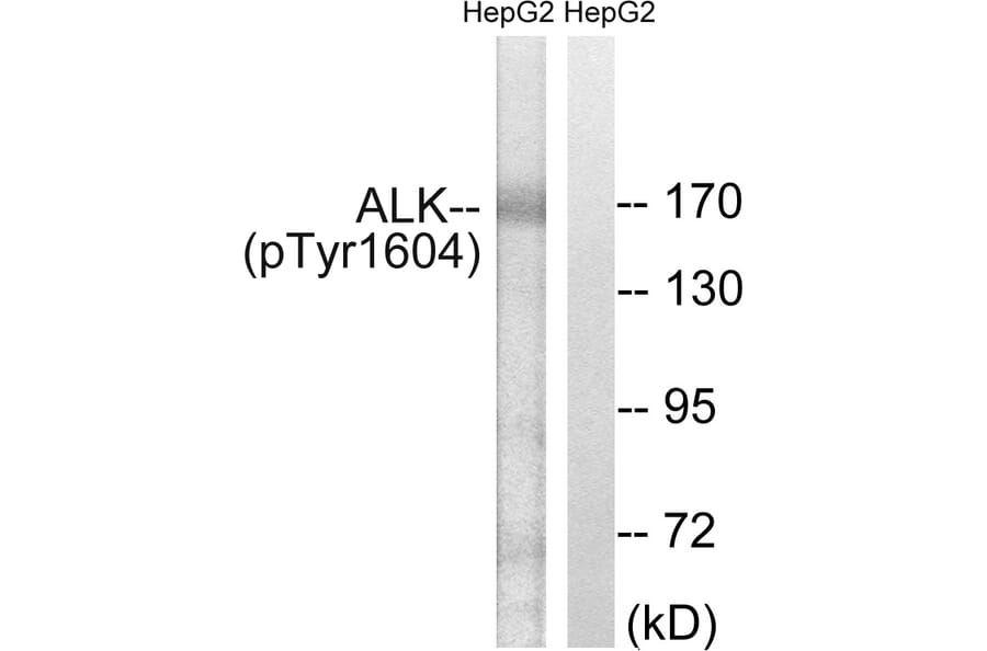 Western blot - ALK (Phospho-Tyr1604) Antibody from Signalway Antibody (12127) - Antibodies.com