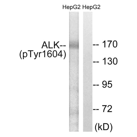 Western blot - ALK (Phospho-Tyr1604) Antibody from Signalway Antibody (12127) - Antibodies.com