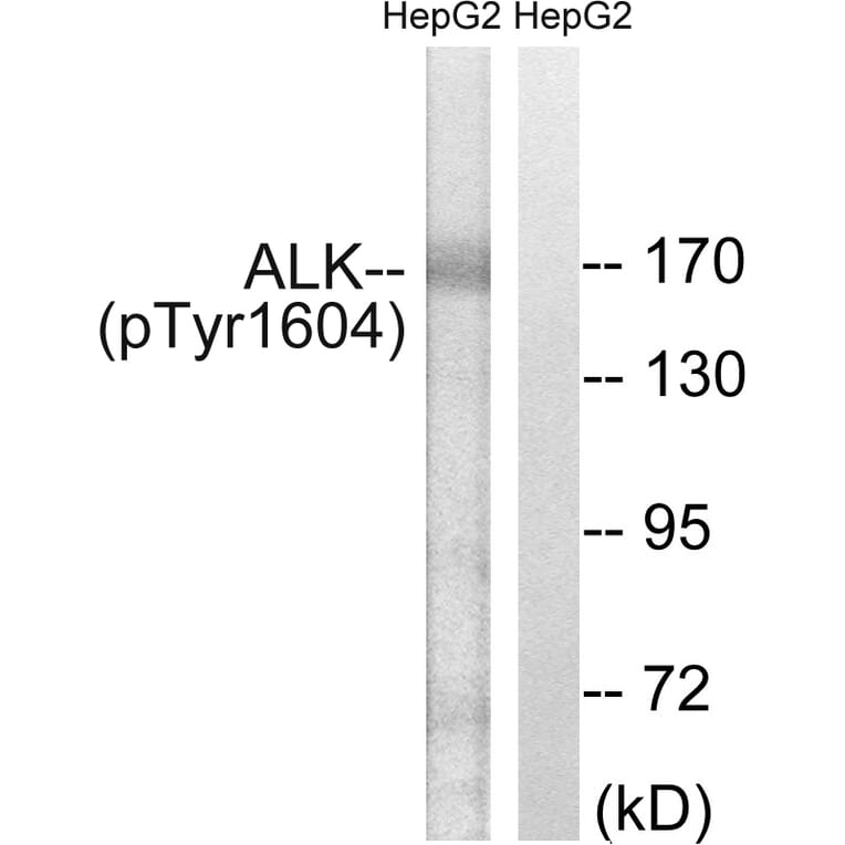 Western blot - ALK (Phospho-Tyr1604) Antibody from Signalway Antibody (12127) - Antibodies.com