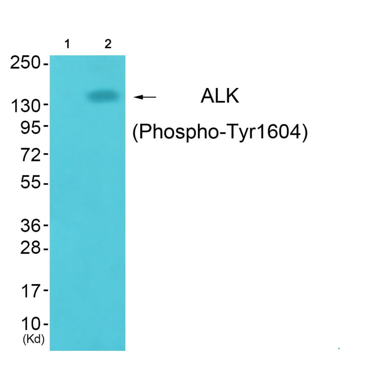 Western blot - ALK (Phospho-Tyr1604) Antibody from Signalway Antibody (12127) - Antibodies.com