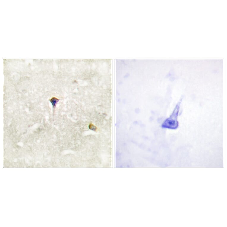 Immunohistochemistry - ALK (Phospho-Tyr1604) Antibody from Signalway Antibody (12127) - Antibodies.com