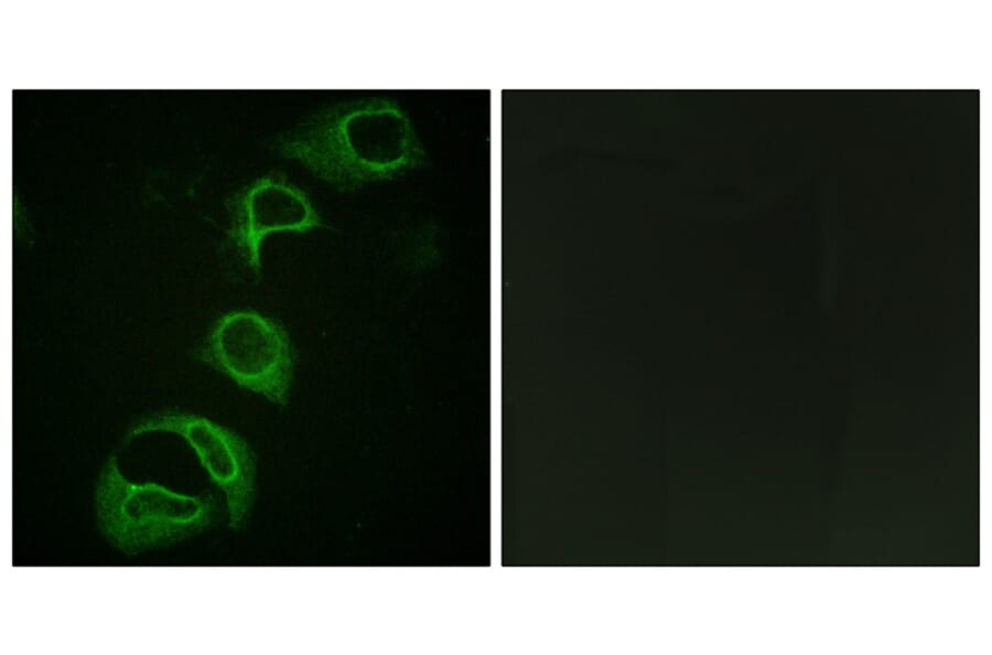 Immunofluorescence - ALK (Phospho-Tyr1604) Antibody from Signalway Antibody (12127) - Antibodies.com