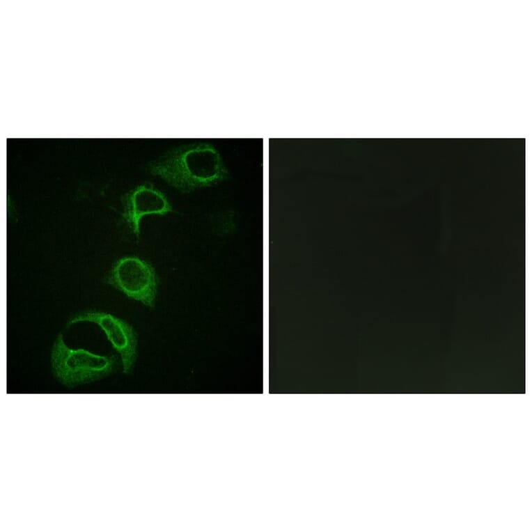 Immunofluorescence - ALK (Phospho-Tyr1604) Antibody from Signalway Antibody (12127) - Antibodies.com