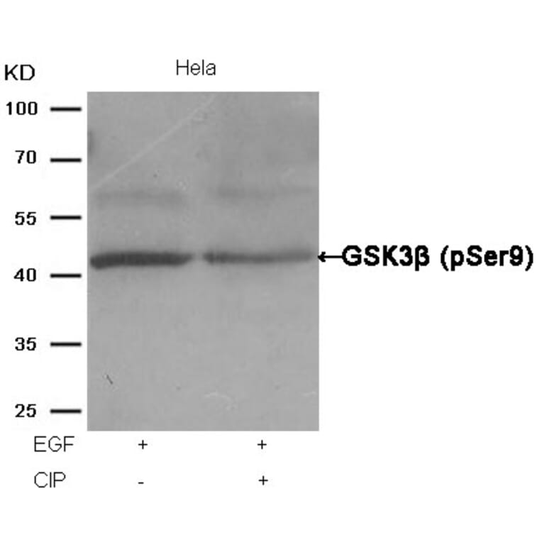 Western blot - GSK3β (Phospho-Ser9) Antibody from Signalway Antibody (11002) - Antibodies.com