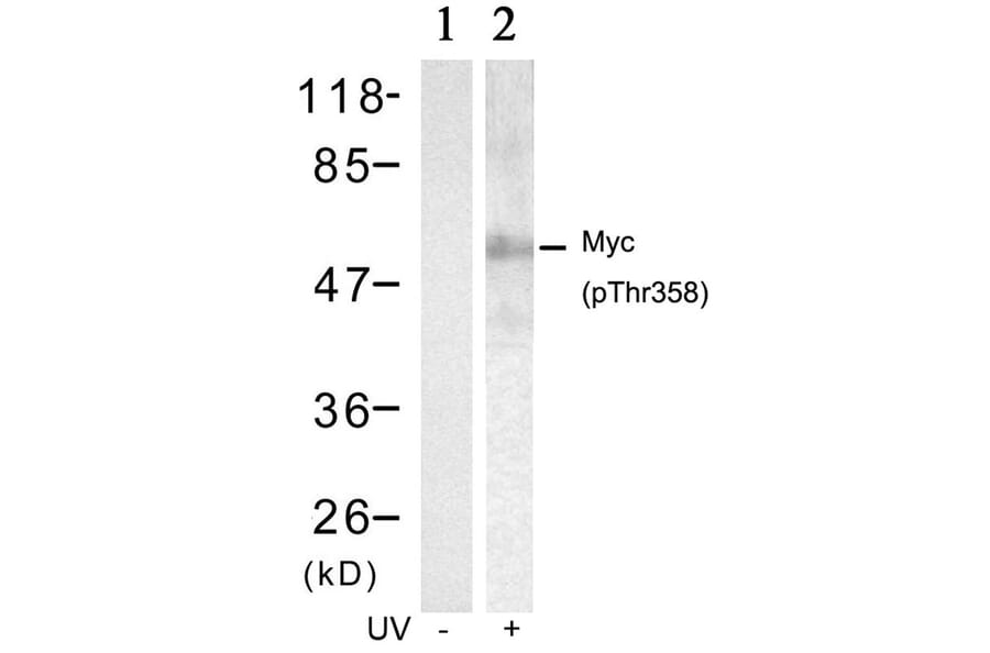 Western blot - Myc (Phospho-Thr358) Antibody from Signalway Antibody (11035) - Antibodies.com