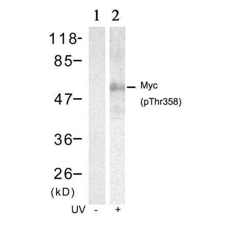 Western blot - Myc (Phospho-Thr358) Antibody from Signalway Antibody (11035) - Antibodies.com