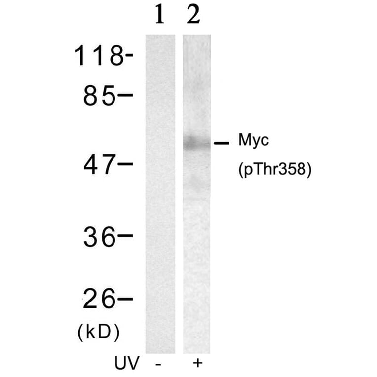 Western blot - Myc (Phospho-Thr358) Antibody from Signalway Antibody (11035) - Antibodies.com