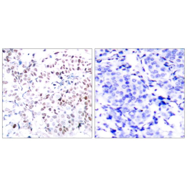 Immunohistochemistry - Myc (Phospho-Thr358) Antibody from Signalway Antibody (11035) - Antibodies.com