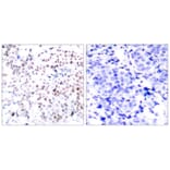 Immunohistochemistry - Myc (Phospho-Thr358) Antibody from Signalway Antibody (11035) - Antibodies.com