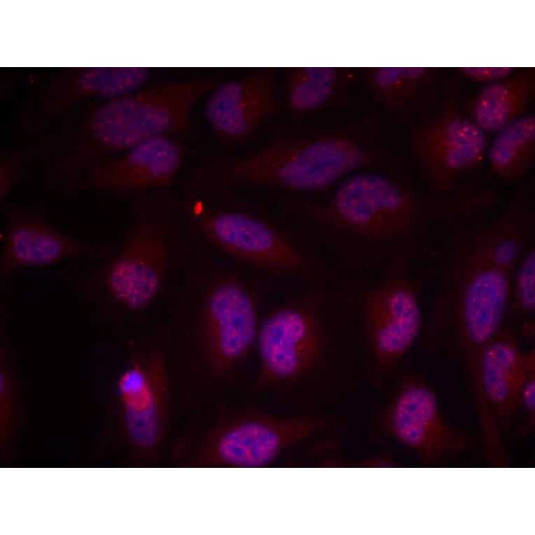 Immunofluorescence - Myc (Phospho-Thr358) Antibody from Signalway Antibody (11035) - Antibodies.com