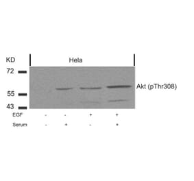 Western blot - Akt (Phospho-Thr308) Antibody from Signalway Antibody (11055) - Antibodies.com