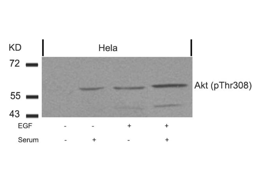 Western blot - Akt (Phospho-Thr308) Antibody from Signalway Antibody (11055) - Antibodies.com