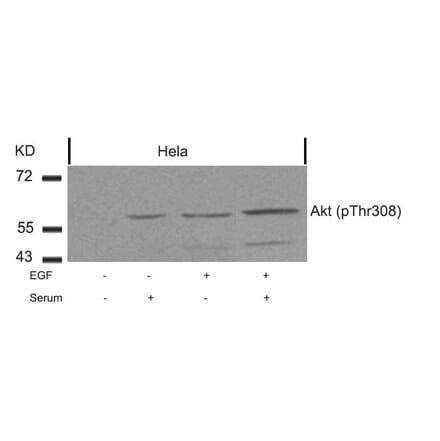 Western blot - Akt (Phospho-Thr308) Antibody from Signalway Antibody (11055) - Antibodies.com