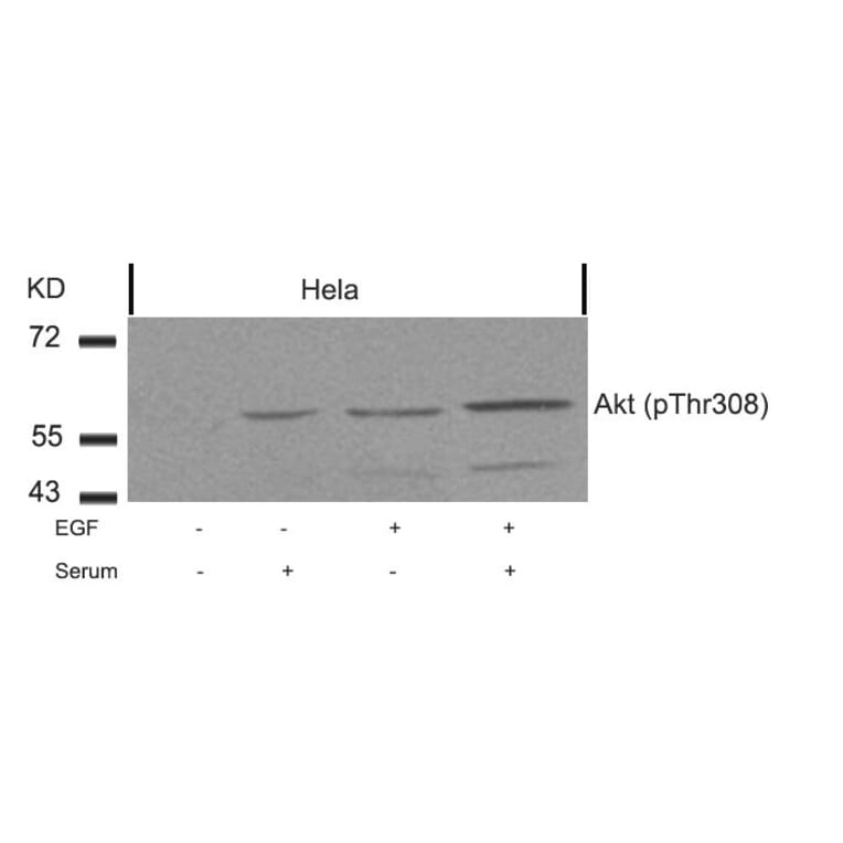 Western blot - Akt (Phospho-Thr308) Antibody from Signalway Antibody (11055) - Antibodies.com