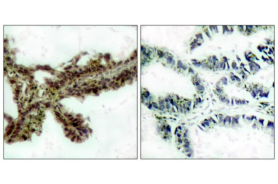 Immunohistochemistry - Akt (Phospho-Thr308) Antibody from Signalway Antibody (11055) - Antibodies.com