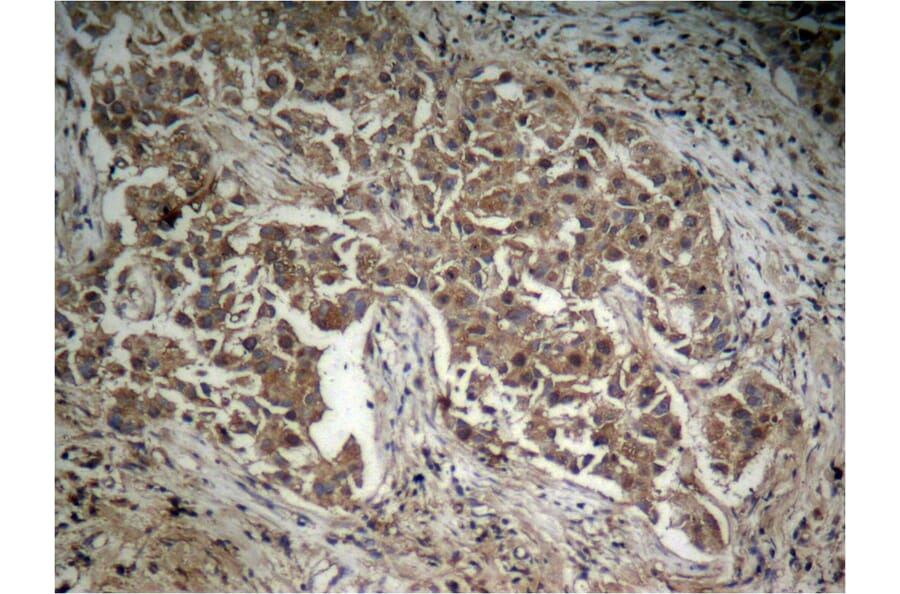 Immunohistochemistry - Akt (Phospho-Thr308) Antibody from Signalway Antibody (11055) - Antibodies.com