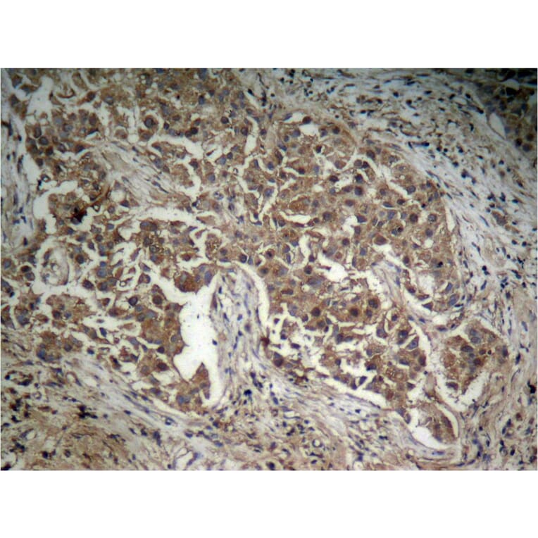 Immunohistochemistry - Akt (Phospho-Thr308) Antibody from Signalway Antibody (11055) - Antibodies.com