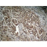 Immunohistochemistry - Akt (Phospho-Thr308) Antibody from Signalway Antibody (11055) - Antibodies.com