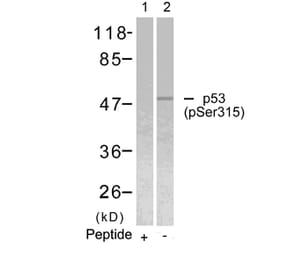 Western blot - p53 (Phospho-Ser315) Antibody from Signalway Antibody (11100) - Antibodies.com
