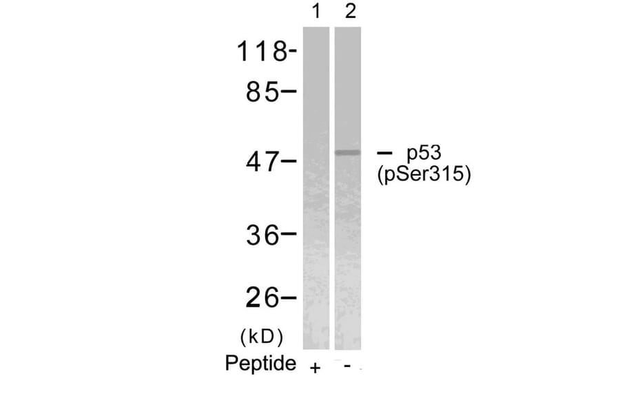 Western blot - p53 (Phospho-Ser315) Antibody from Signalway Antibody (11100) - Antibodies.com