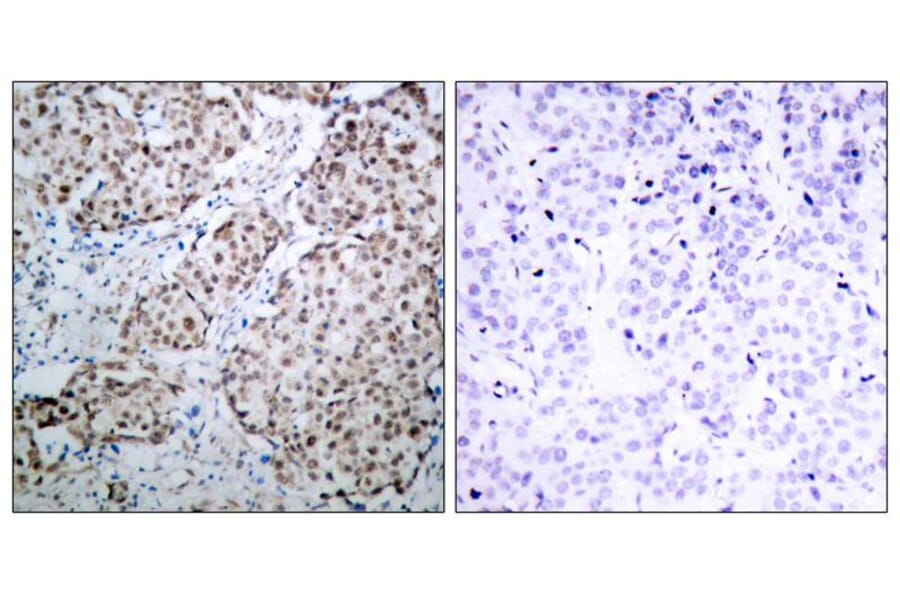 Immunohistochemistry - p53 (Phospho-Ser315) Antibody from Signalway Antibody (11100) - Antibodies.com