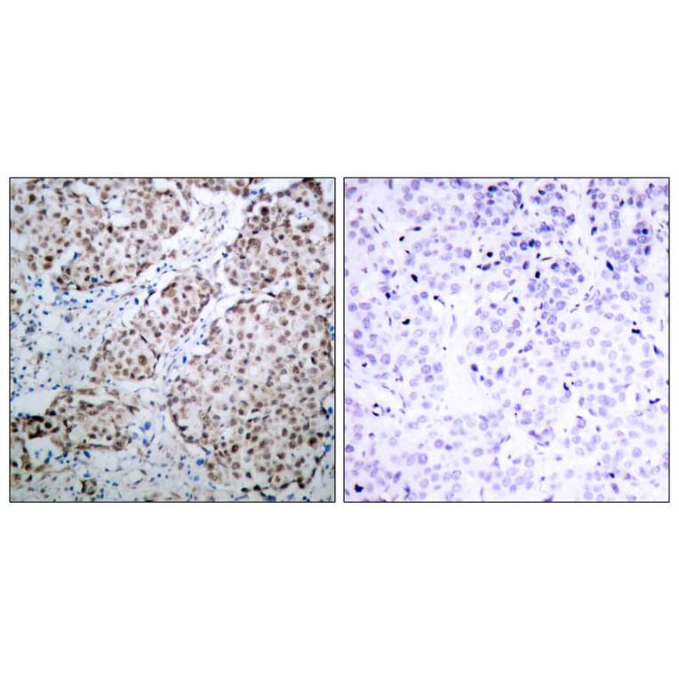 Immunohistochemistry - p53 (Phospho-Ser315) Antibody from Signalway Antibody (11100) - Antibodies.com