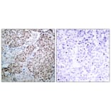 Immunohistochemistry - p53 (Phospho-Ser315) Antibody from Signalway Antibody (11100) - Antibodies.com