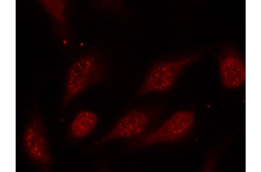 Immunofluorescence - p53 (Phospho-Ser315) Antibody from Signalway Antibody (11100) - Antibodies.com