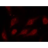 Immunofluorescence - p53 (Phospho-Ser315) Antibody from Signalway Antibody (11100) - Antibodies.com