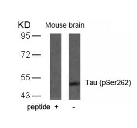Western blot - Tau (Phospho-Ser262) Antibody from Signalway Antibody (11111) - Antibodies.com