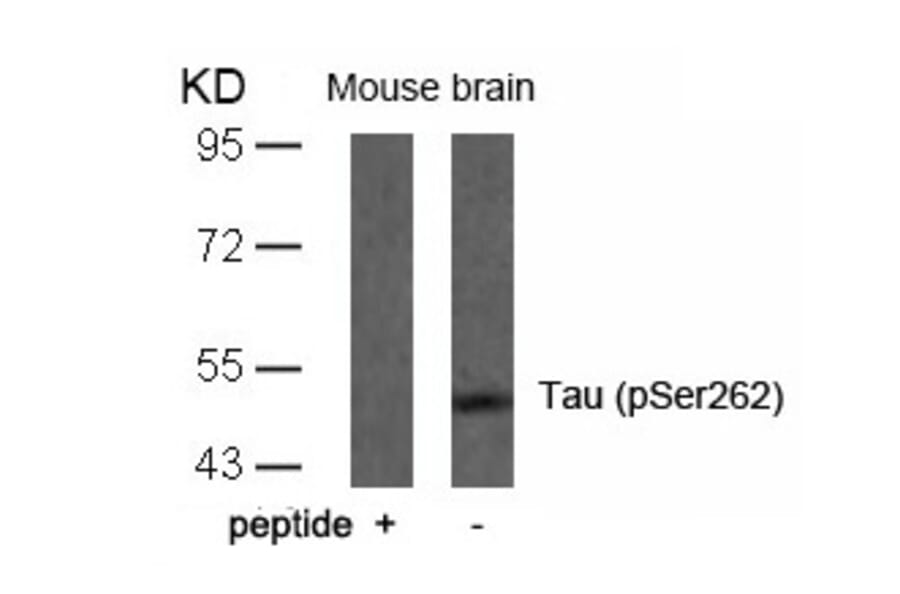 Western blot - Tau (Phospho-Ser262) Antibody from Signalway Antibody (11111) - Antibodies.com