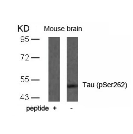 Western blot - Tau (Phospho-Ser262) Antibody from Signalway Antibody (11111) - Antibodies.com