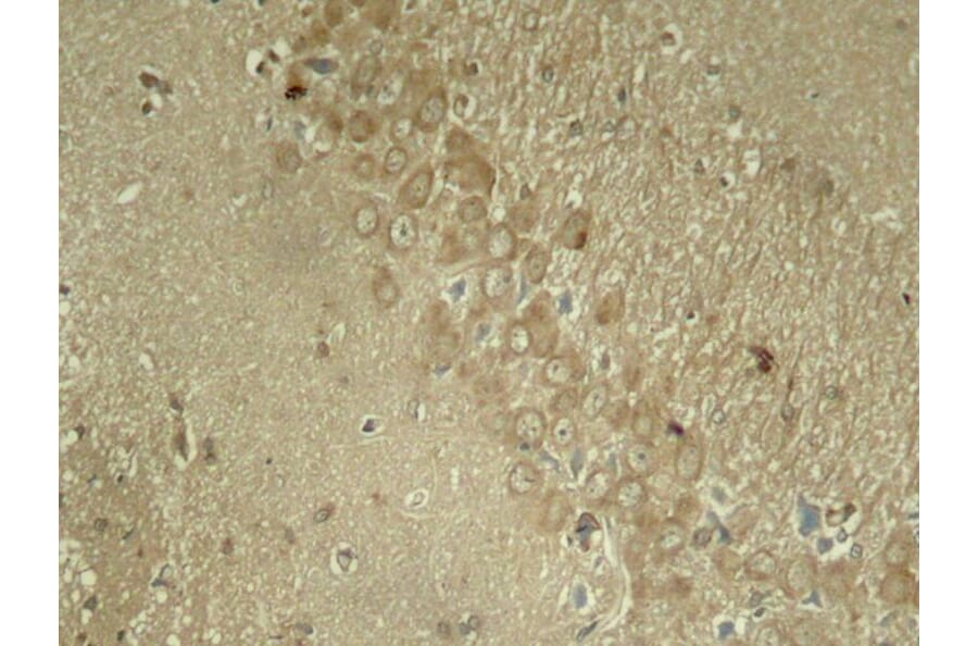 Immunohistochemistry - Tau (Phospho-Ser262) Antibody from Signalway Antibody (11111) - Antibodies.com