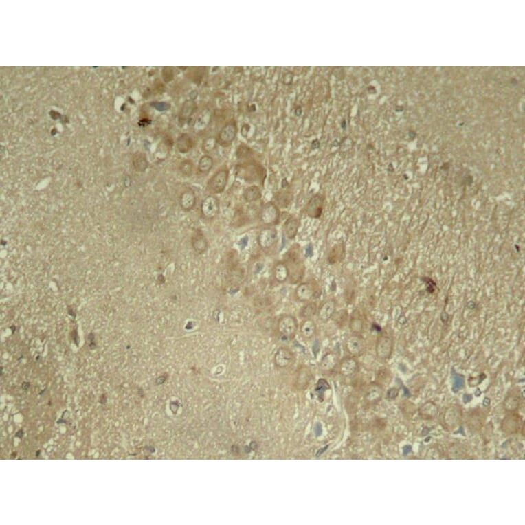 Immunohistochemistry - Tau (Phospho-Ser262) Antibody from Signalway Antibody (11111) - Antibodies.com