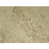 Immunohistochemistry - Tau (Phospho-Ser262) Antibody from Signalway Antibody (11111) - Antibodies.com