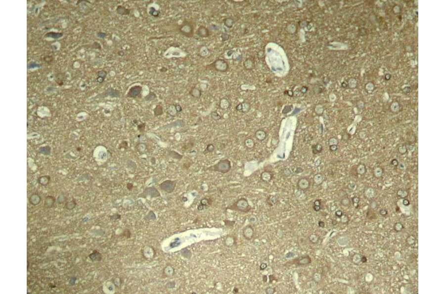 Immunohistochemistry - Tau (Phospho-Ser404) Antibody from Signalway Antibody (11112) - Antibodies.com