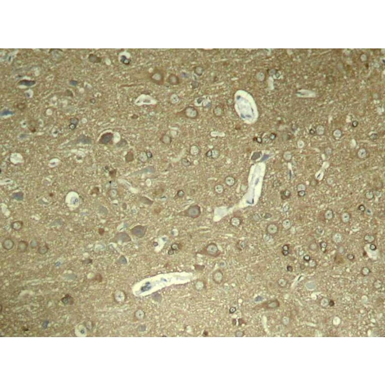 Immunohistochemistry - Tau (Phospho-Ser404) Antibody from Signalway Antibody (11112) - Antibodies.com