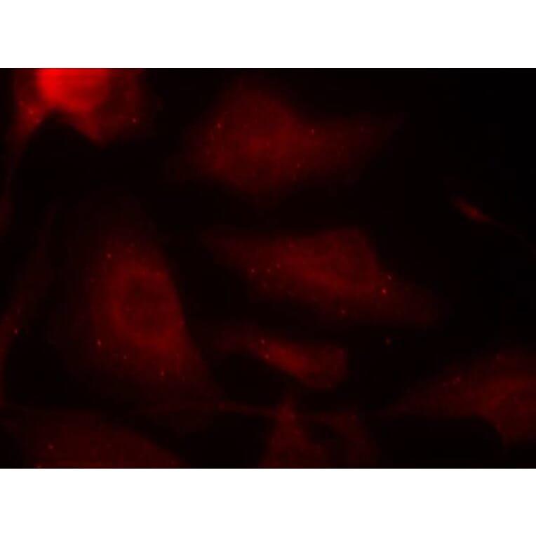 Immunofluorescence - Tau (Phospho-Ser404) Antibody from Signalway Antibody (11112) - Antibodies.com