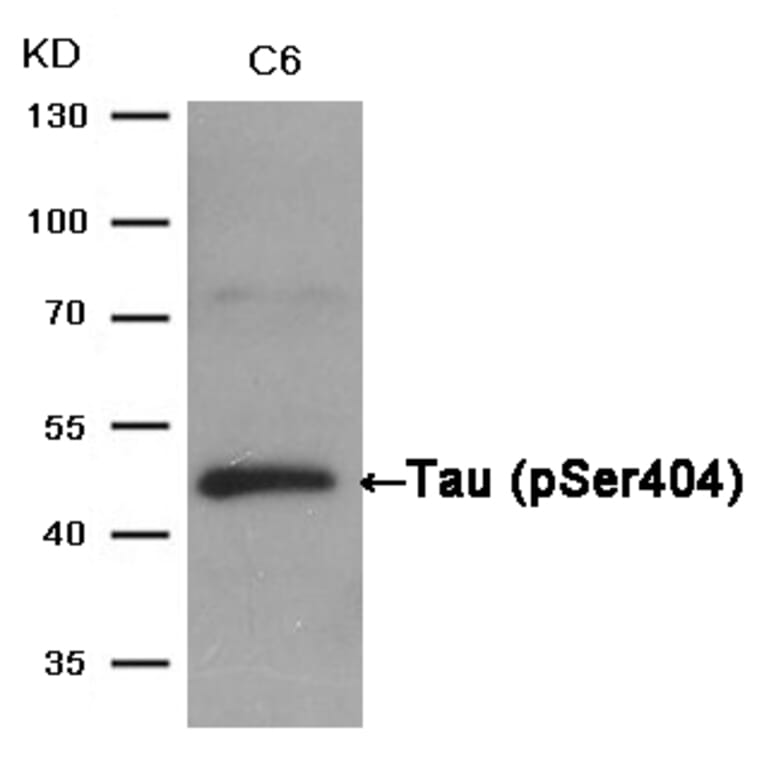 Western blot - Tau (Phospho-Ser404) Antibody from Signalway Antibody (11112) - Antibodies.com