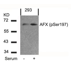 Western blot - AFX (Phospho-Ser197) Antibody from Signalway Antibody (11137) - Antibodies.com