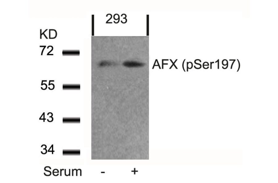 Western blot - AFX (Phospho-Ser197) Antibody from Signalway Antibody (11137) - Antibodies.com