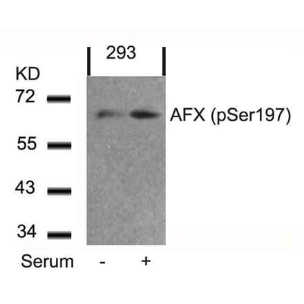Western blot - AFX (Phospho-Ser197) Antibody from Signalway Antibody (11137) - Antibodies.com